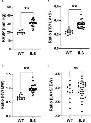 Lung-specific interleukin 6 mediated transglutaminase 2 activation and cardiopulmonary fibrogenesis